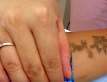 fading an unwanted forearm tattoo